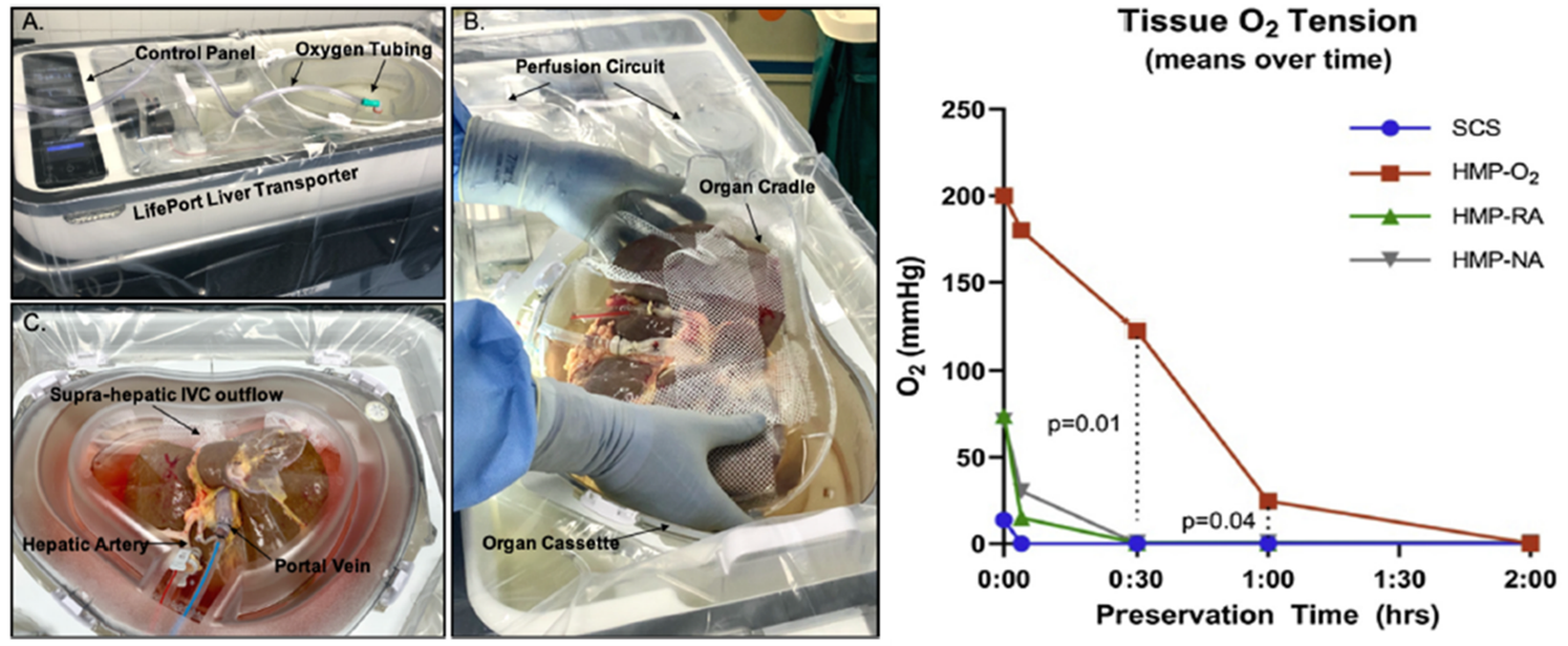 Picture2_Transplantation Oxford article.png
